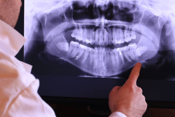 Best Emergency Cosmetic Dentistry in Laguna Niguel, CA