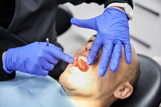 Best Emergency Dentist for Lost Fillings or Crowns in Laguna Niguel, CA