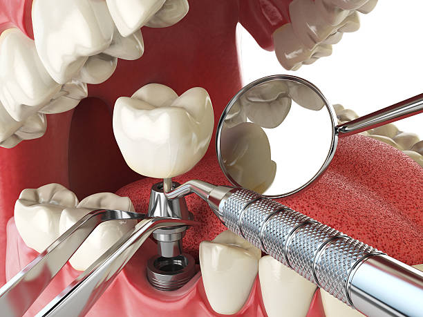 Best Emergency Dental Services for Seniors in Laguna Niguel, CA